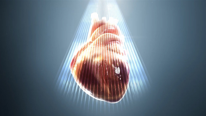 HeartModelᴬ&sdot;ᴵ&sdot; for echocardiography